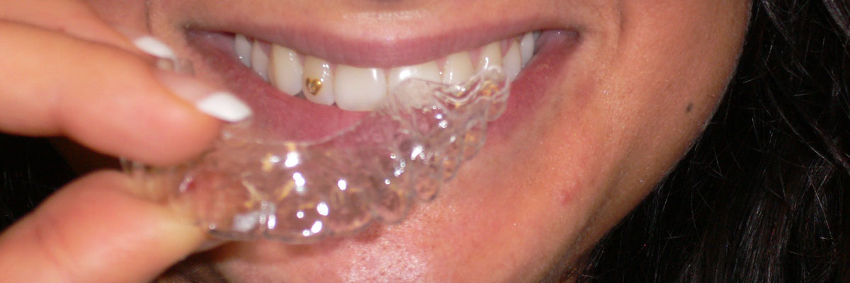Clear-Aligner Almedico GmbH